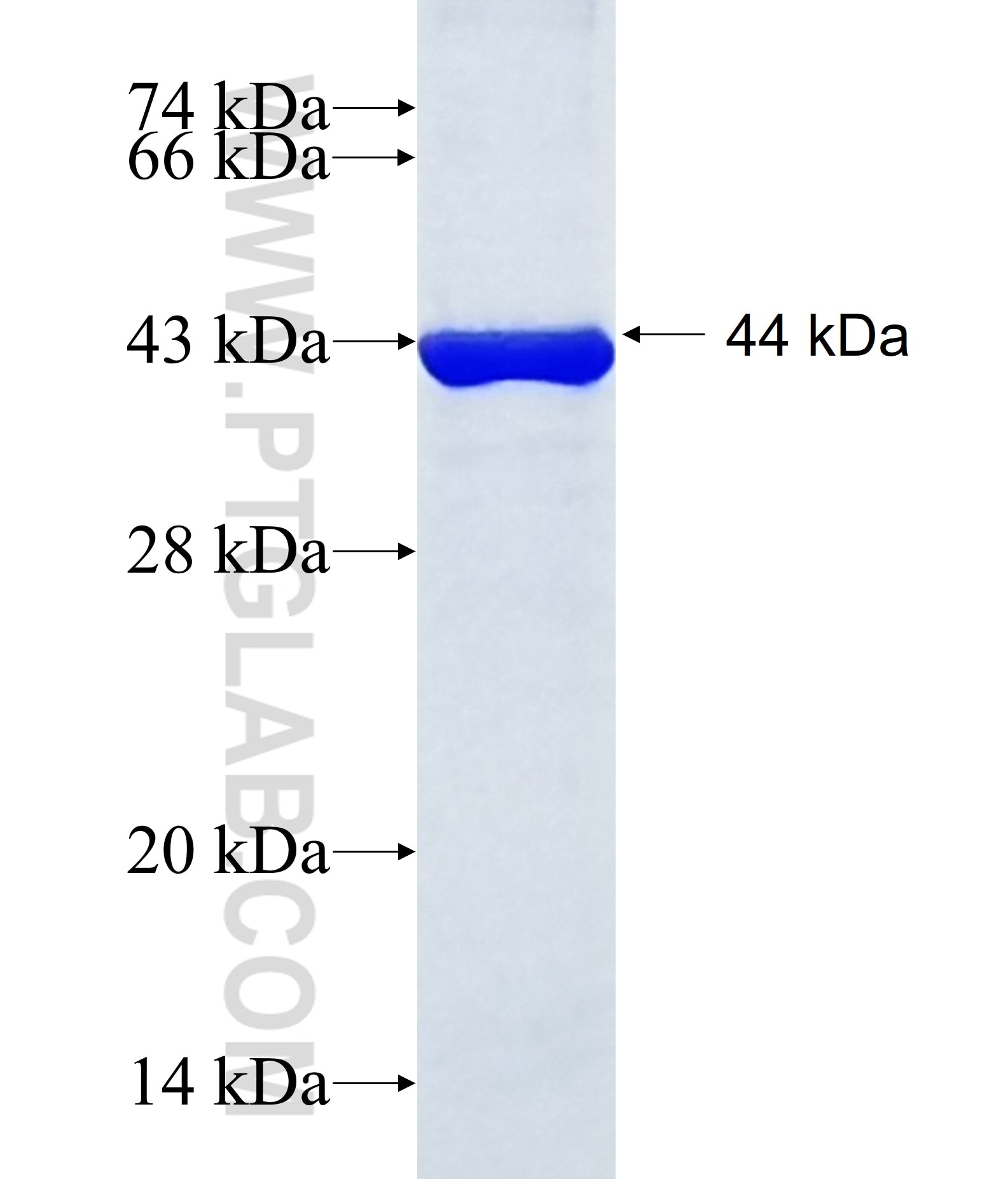 BARD1 fusion protein Ag18965 SDS-PAGE