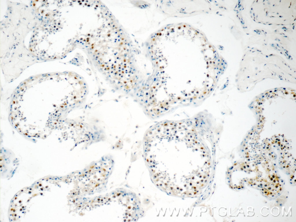 IHC staining of human testis using 23976-1-AP