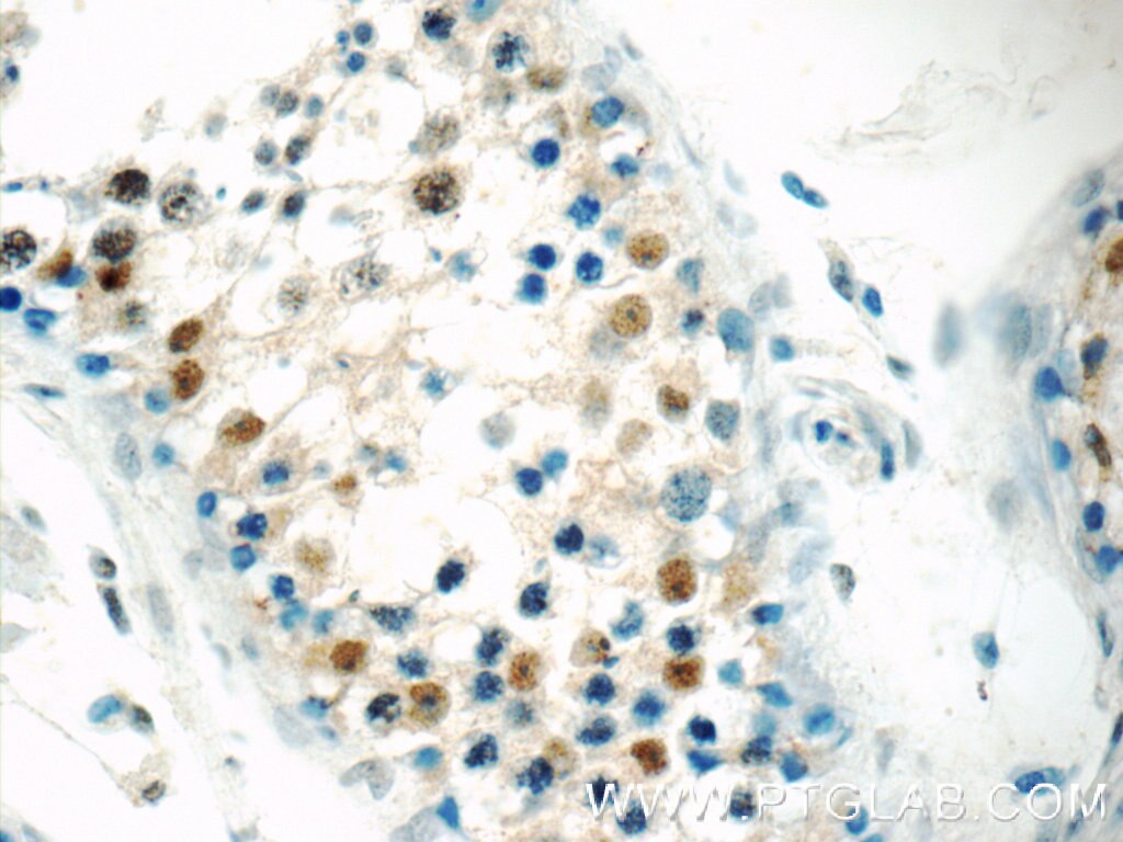 Immunohistochemistry (IHC) staining of human testis tissue using BARHL2 Polyclonal antibody (23976-1-AP)