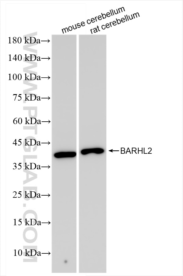 Western Blot (WB) analysis of various lysates using BARHL2 Recombinant antibody (83596-4-RR)