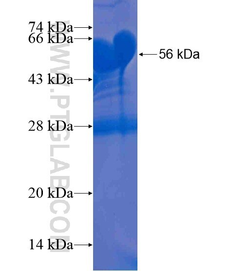 BARHL2 fusion protein Ag21156 SDS-PAGE
