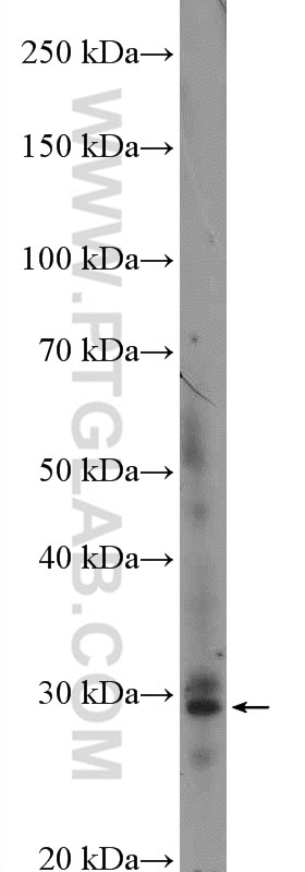 Western Blot (WB) analysis of mouse heart tissue using BARX1 Polyclonal antibody (27281-1-AP)