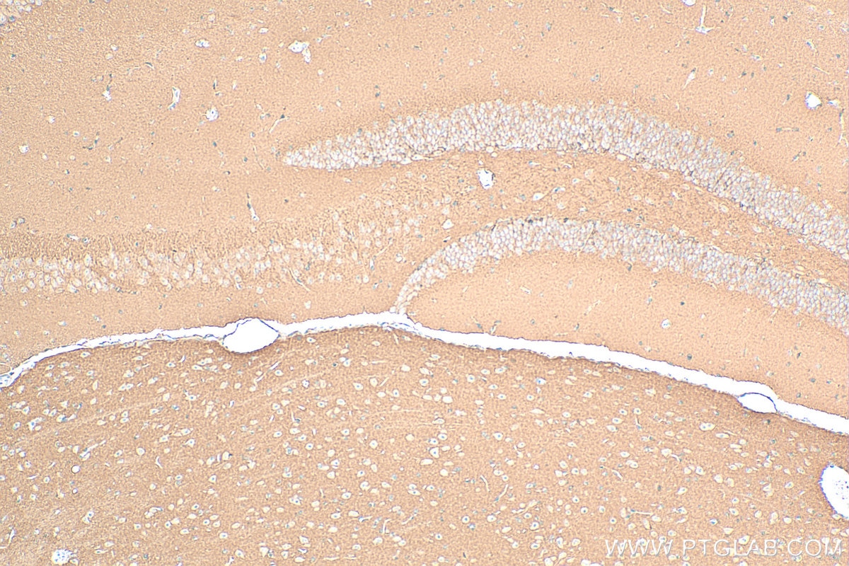 Immunohistochemistry (IHC) staining of mouse brain tissue using BASP1 Polyclonal antibody (14880-1-AP)