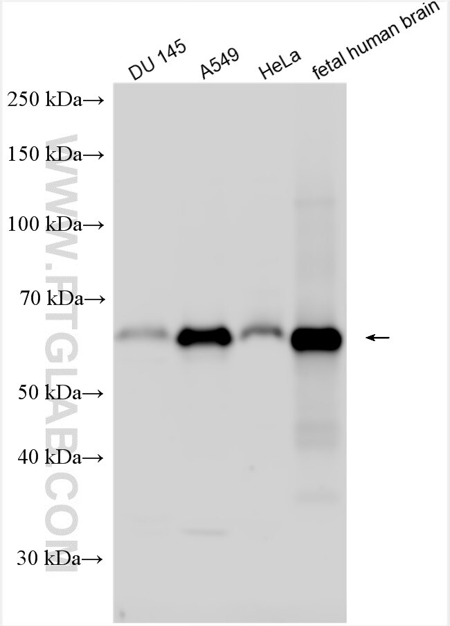 Western Blot (WB) analysis of various lysates using BASP1 Polyclonal antibody (14880-1-AP)