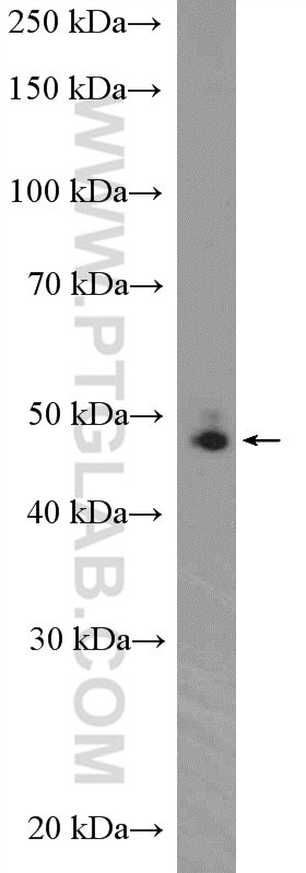 Western Blot (WB) analysis of Jurkat cells using DDX39B Polyclonal antibody (14798-1-AP)