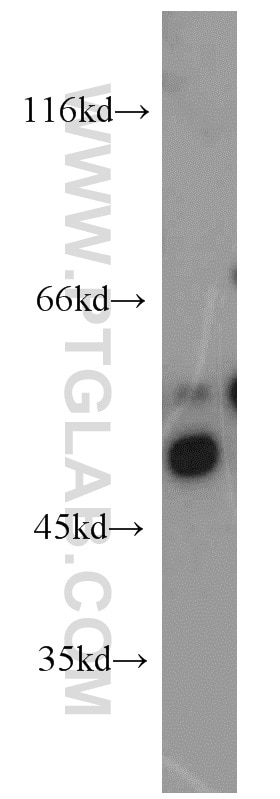 Western Blot (WB) analysis of Jurkat cells using DDX39B Polyclonal antibody (14798-1-AP)