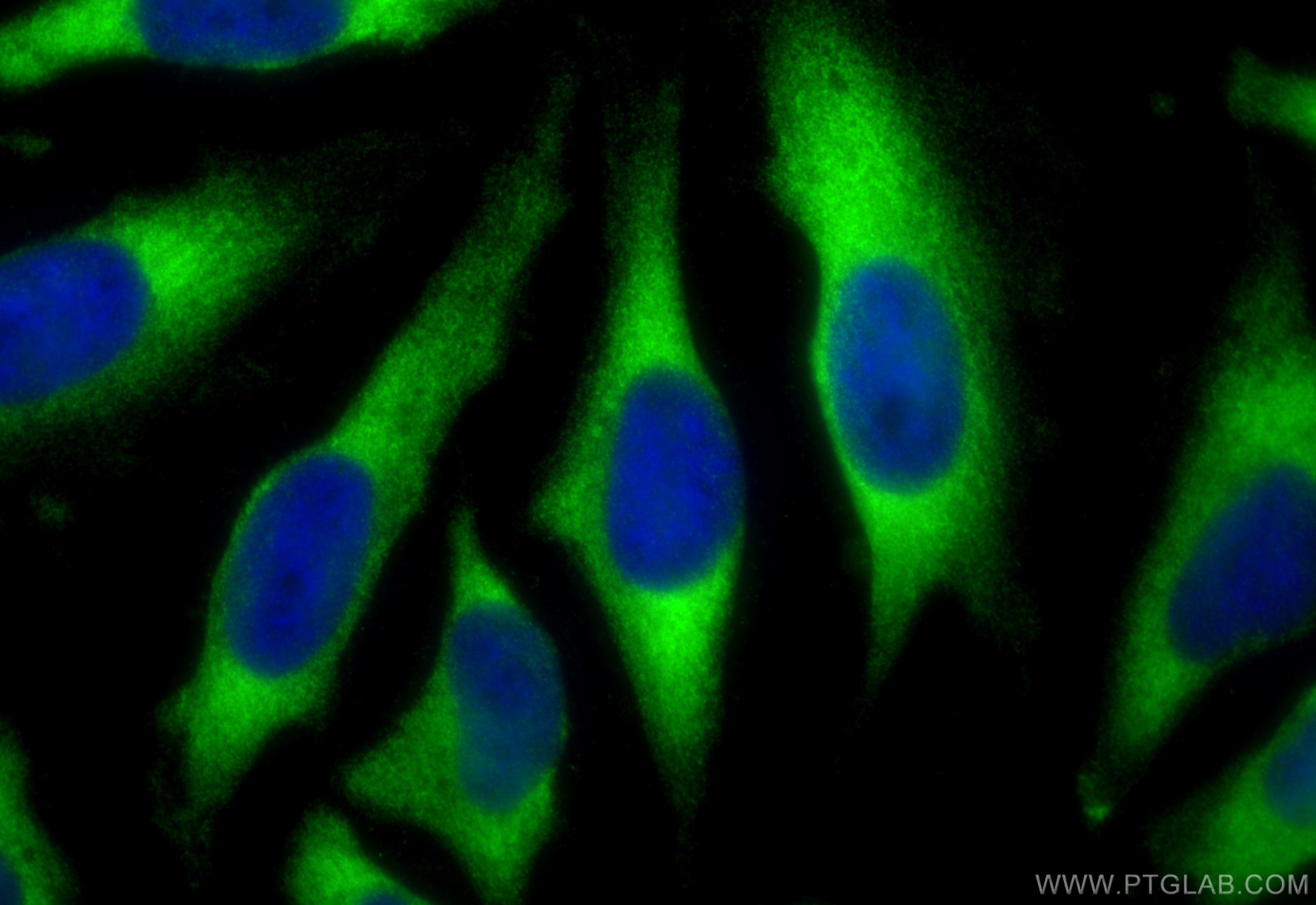 Immunofluorescence (IF) / fluorescent staining of HeLa cells using PRRC2C Polyclonal antibody (31383-1-AP)