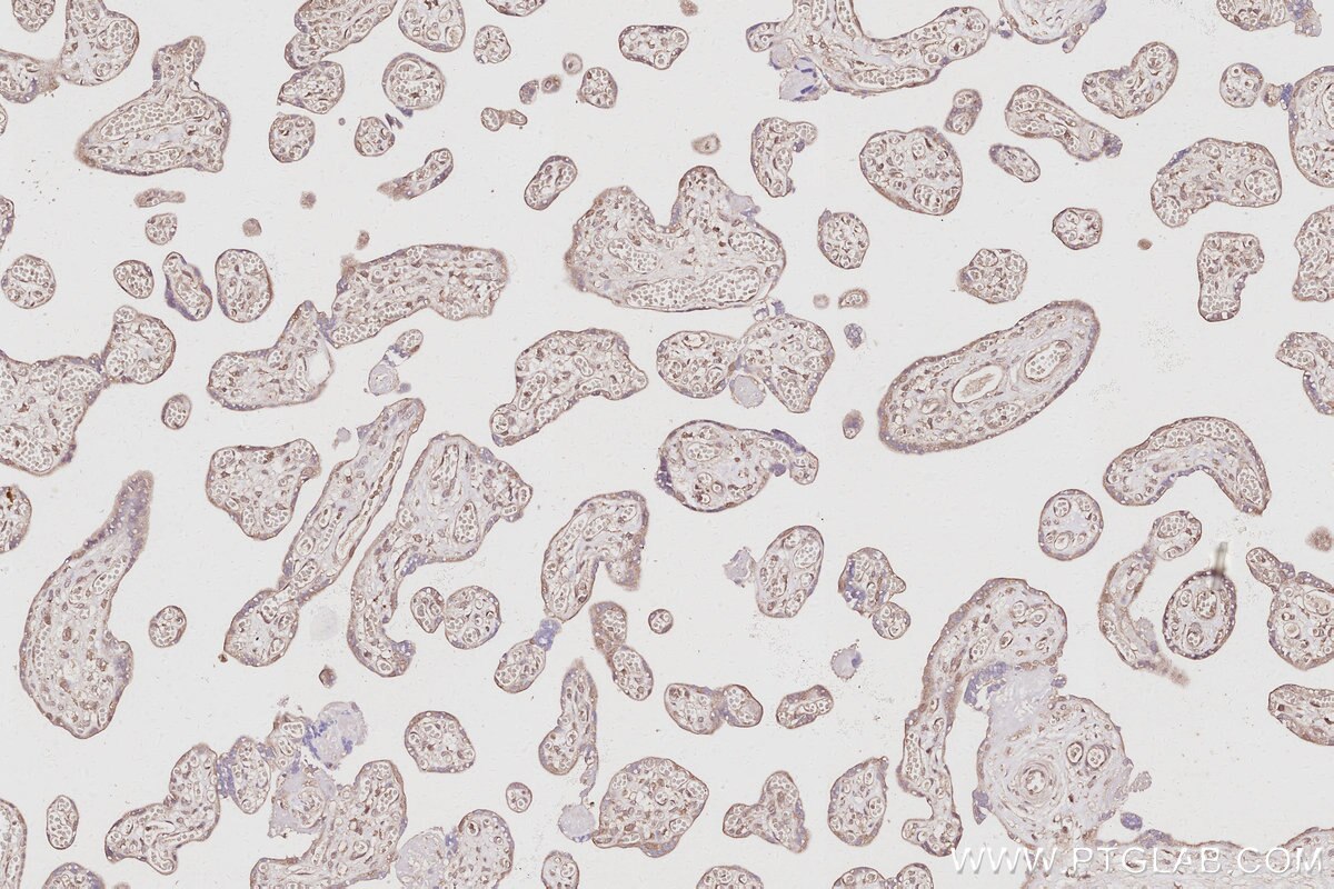 IHC staining of human placenta using 31383-1-AP (same clone as 31383-1-PBS) Immunohistochemistry (IHC) staining of human placenta tissue using PRRC2C Polyclonal antibody (31383-1-AP)