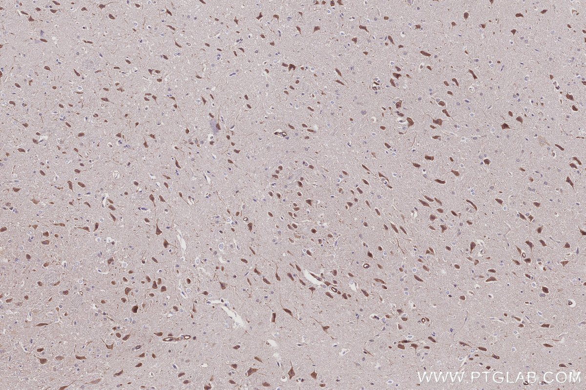 IHC staining of rat brain using 31383-1-AP (same clone as 31383-1-PBS) Immunohistochemistry (IHC) staining of rat brain tissue using PRRC2C Polyclonal antibody (31383-1-AP)