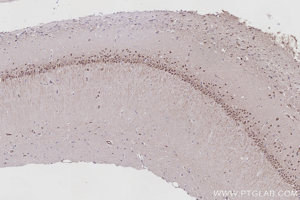 IHC staining of rat brain using 31383-1-AP (same clone as 31383-1-PBS) Immunohistochemistry (IHC) staining of rat brain tissue using PRRC2C Polyclonal antibody (31383-1-AP)