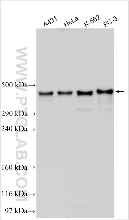 Western Blot (WB) analysis of various lysates using PRRC2C Polyclonal antibody (31383-1-AP)