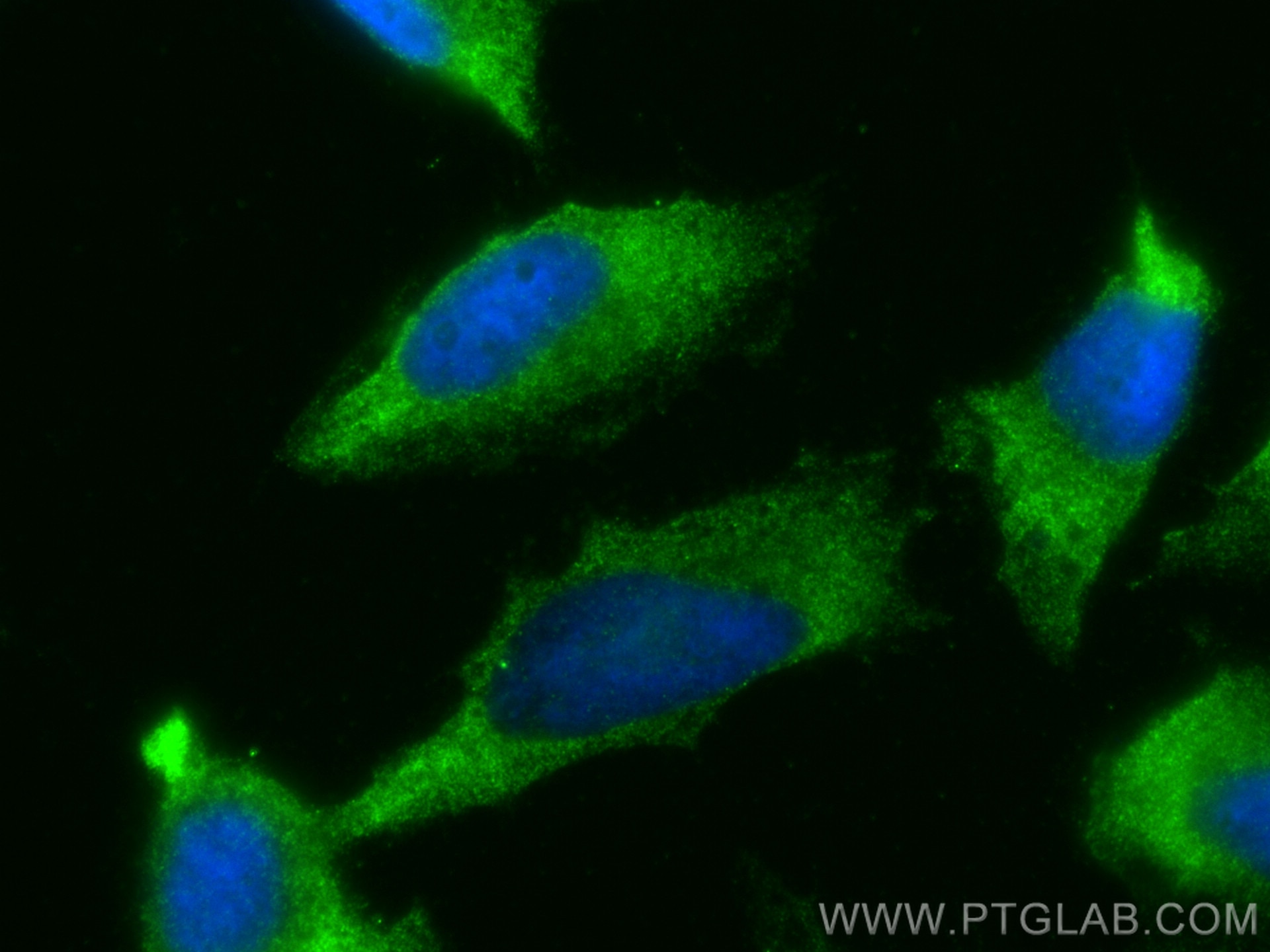 Immunofluorescence (IF) / fluorescent staining of HeLa cells using BAT2L Polyclonal antibody (21455-1-AP)