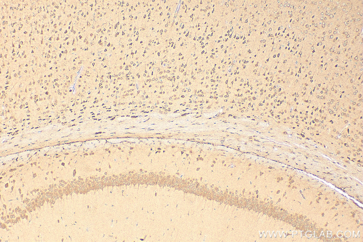 Immunohistochemistry (IHC) staining of mouse brain tissue using BAT5 Polyclonal antibody (17317-1-AP)