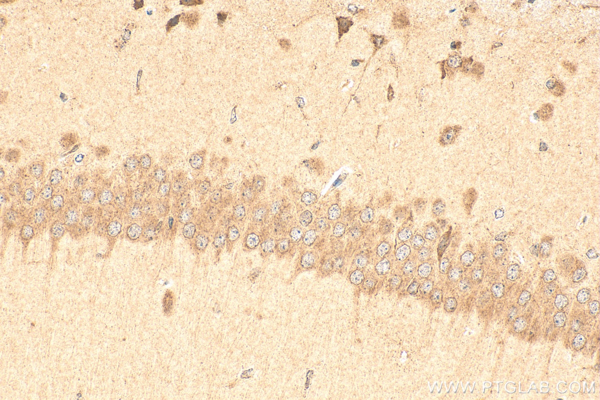 Immunohistochemistry (IHC) staining of mouse brain tissue using BAT5 Polyclonal antibody (17317-1-AP)