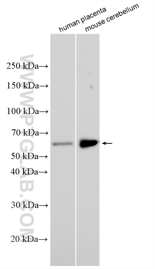 Western Blot (WB) analysis of various lysates using BAT5 Polyclonal antibody (17317-1-AP)