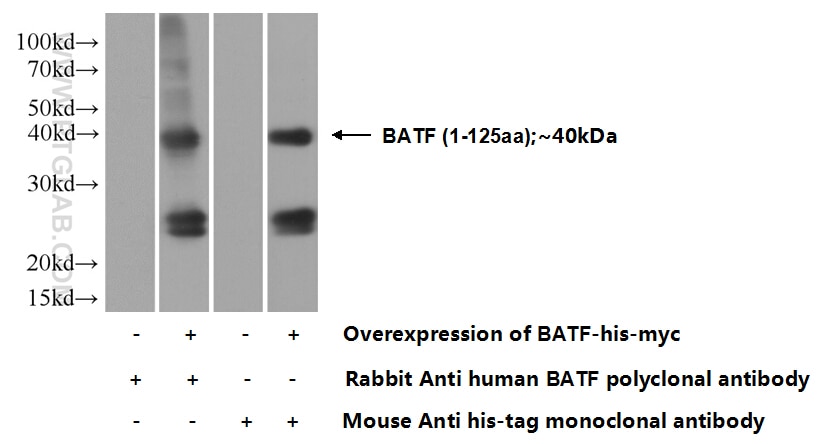 WB analysis of Transfected HEK-293 using 13507-1-AP