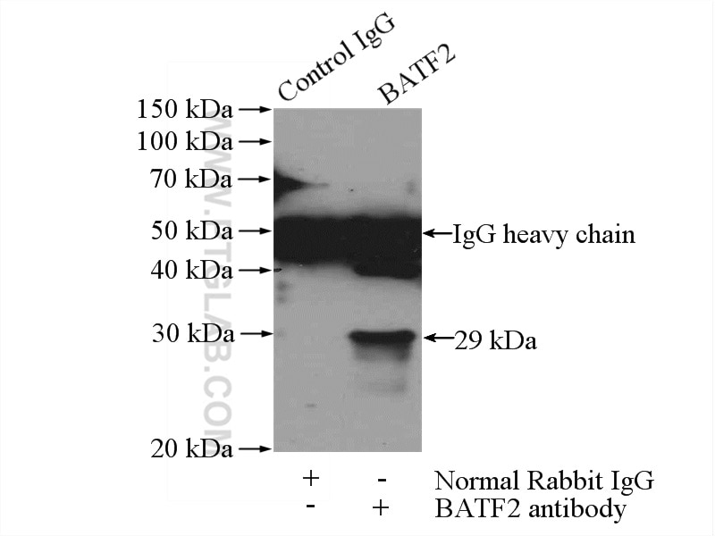 Immunoprecipitation (IP) experiment of HeLa cells using BATF2 Polyclonal antibody (16592-1-AP)