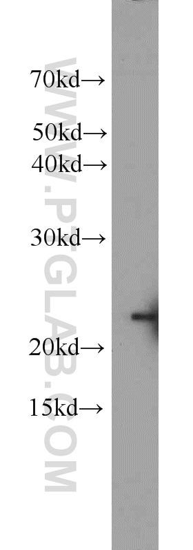 WB analysis of MCF-7 using 23931-1-AP