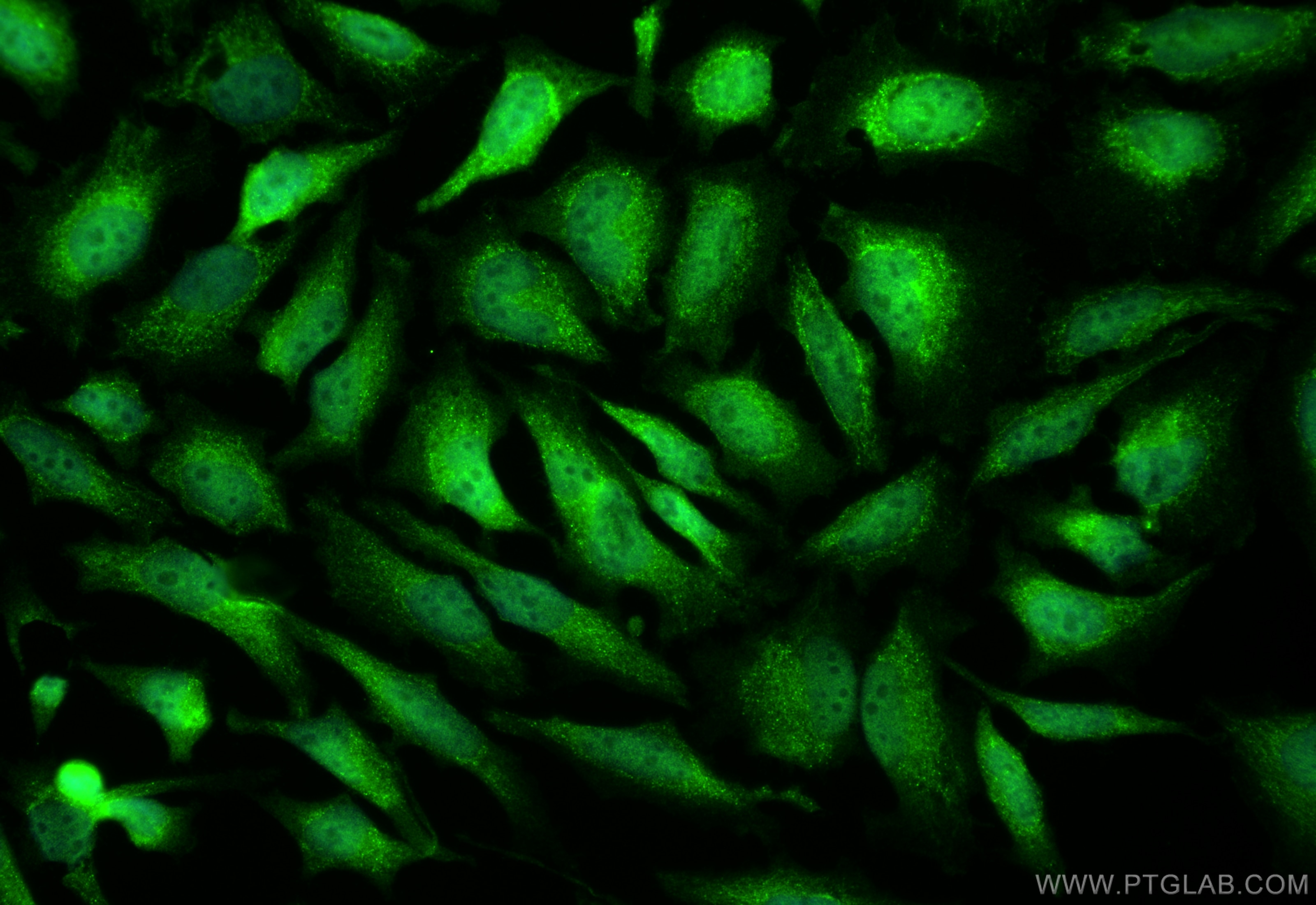 Immunofluorescence (IF) / fluorescent staining of HeLa cells using BAX Polyclonal antibody (50599-2-Ig)