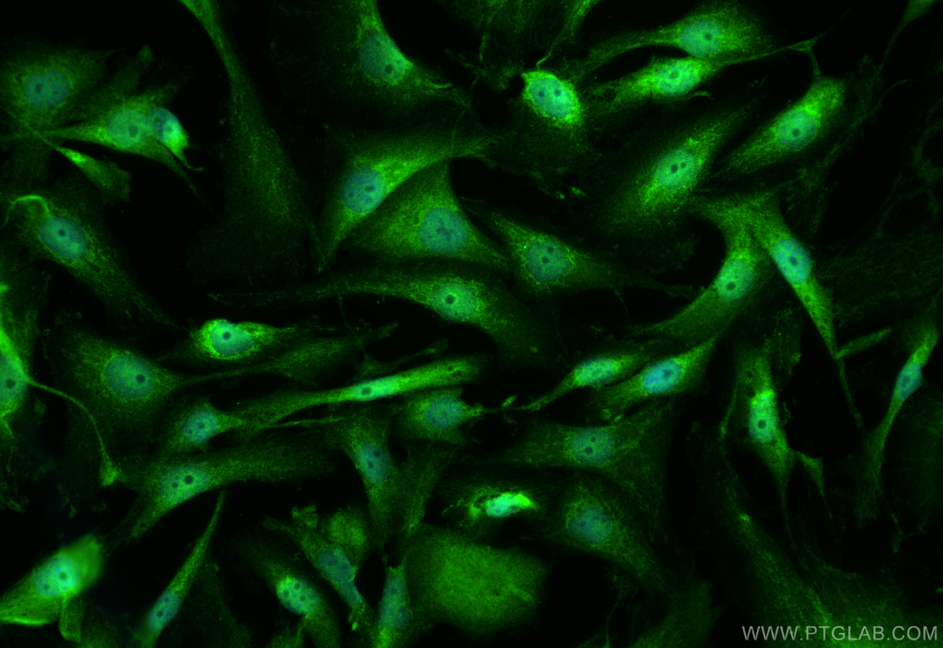 Immunofluorescence (IF) / fluorescent staining of MDA-MB-231 cells using BAX Polyclonal antibody (50599-2-Ig)