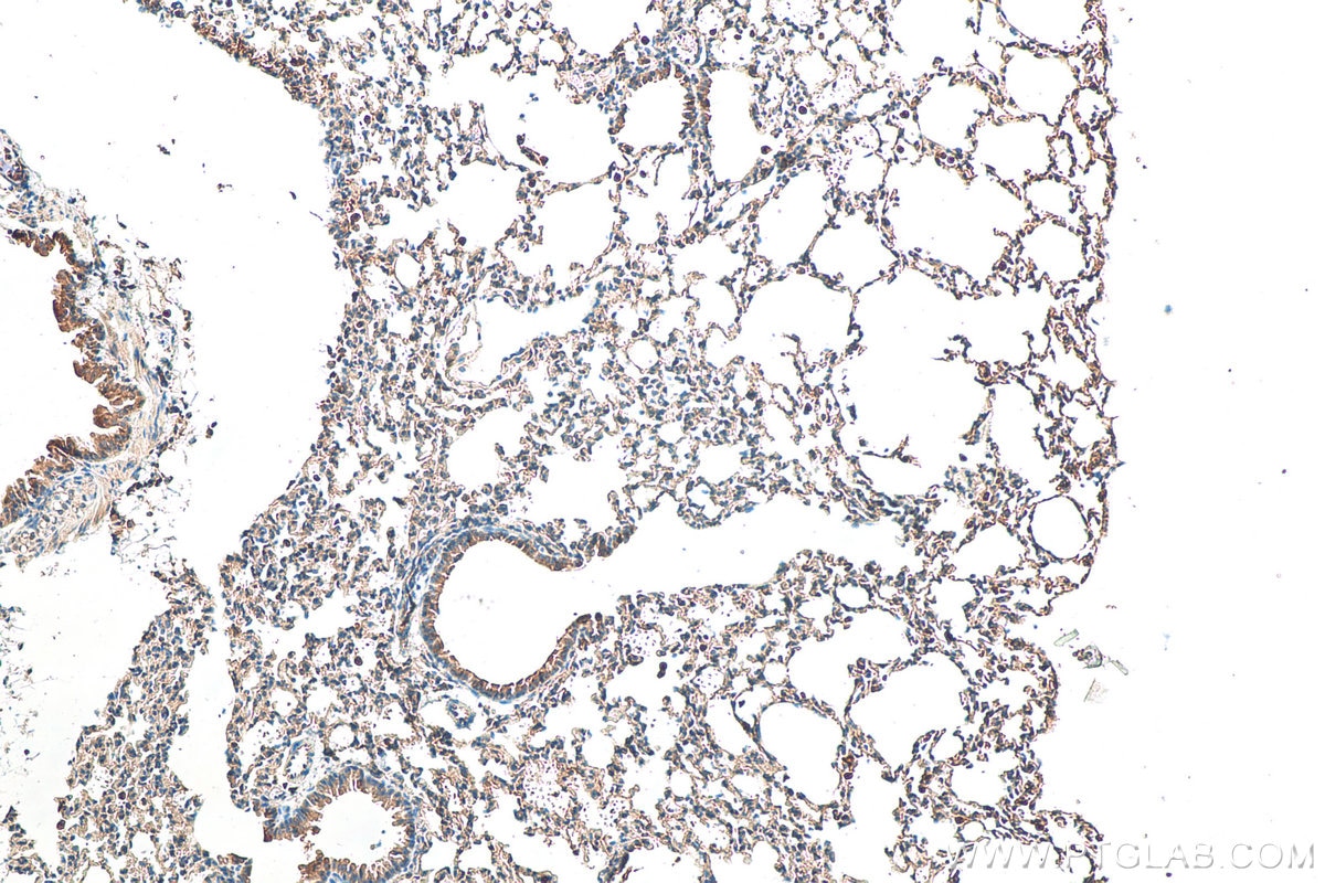 Immunohistochemistry (IHC) staining of mouse lung tissue using BAX Polyclonal antibody (50599-2-Ig)