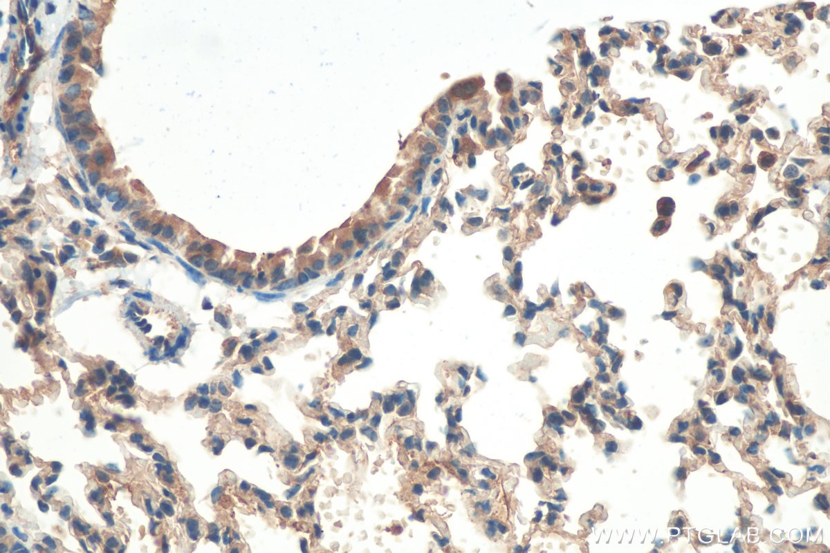 IHC staining of mouse lung using 50599-2-Ig