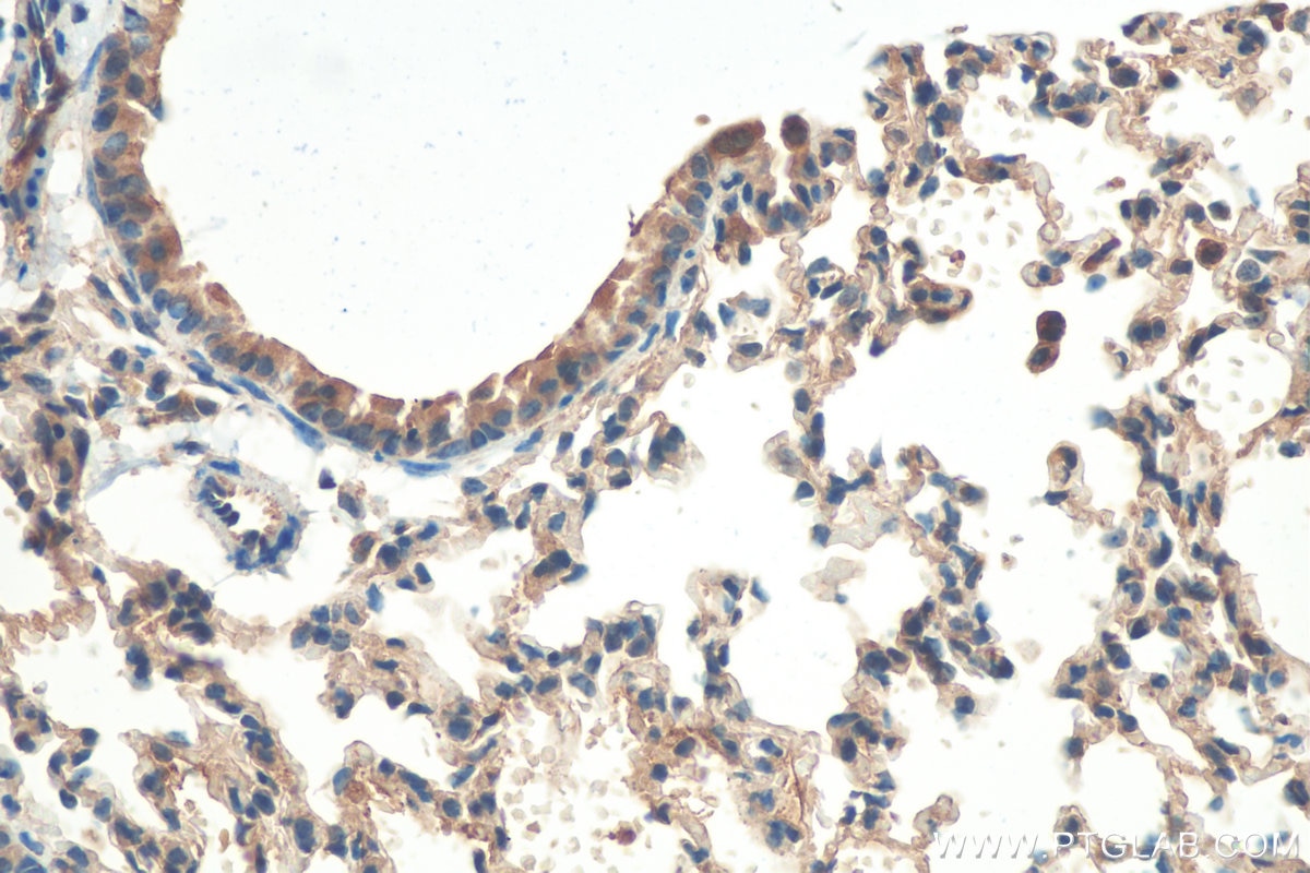 Immunohistochemistry (IHC) staining of mouse lung tissue using BAX Polyclonal antibody (50599-2-Ig)