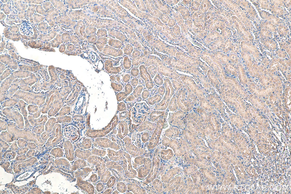 Immunohistochemistry (IHC) staining of mouse kidney tissue using BAX Polyclonal antibody (50599-2-Ig)