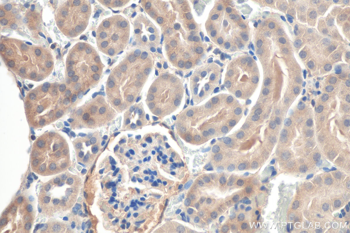 IHC staining of mouse kidney using 50599-2-Ig