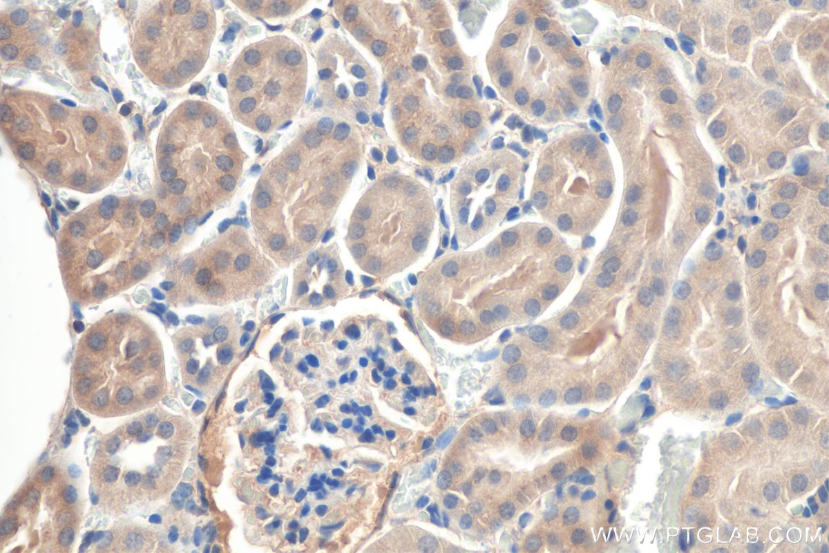 Immunohistochemistry (IHC) staining of mouse kidney tissue using BAX Polyclonal antibody (50599-2-Ig)