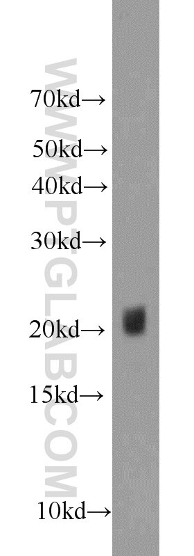 WB analysis of rat kidney using 50599-2-Ig