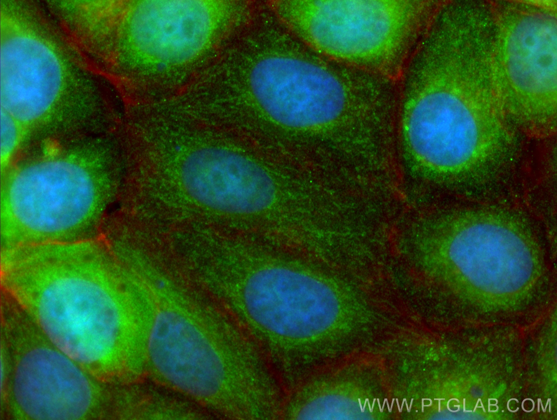 Immunofluorescence (IF) / fluorescent staining of MCF-7 cells using BAX Monoclonal antibody (60267-1-Ig)
