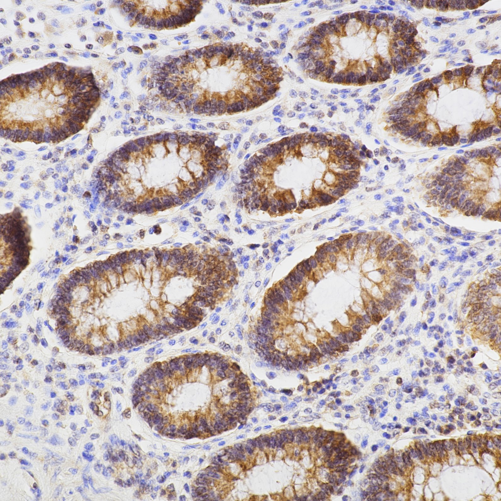 Immunohistochemistry (IHC) staining of human colon tissue using BAX Monoclonal antibody (60267-1-Ig)