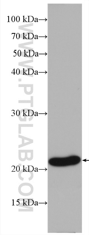 WB analysis of HepG2 using 60267-1-Ig