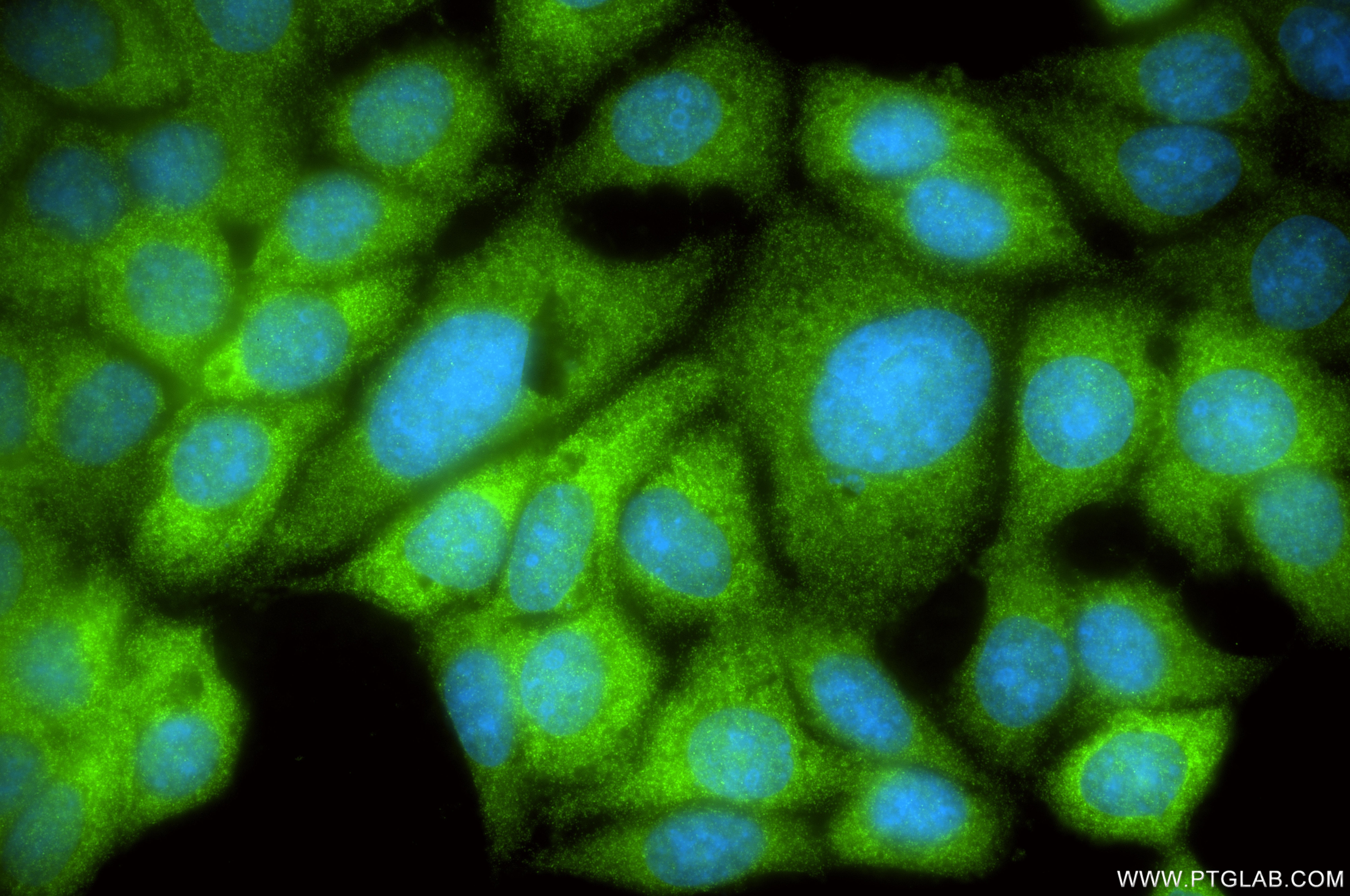Immunofluorescent analysis of (-20°C Methanol) fixed MCF-7 cells using BAX antibody (81789-4-RR, Clone: 252648D5 ) at dilution of 1:200 and CoraLite®488-Conjugated Goat Anti-Rabbit IgG(H+L) (SA00013-2). Immunofluorescence (IF) / fluorescent staining of MCF-7 cells using BAX Recombinant monoclonal antibody (81789-4-RR)