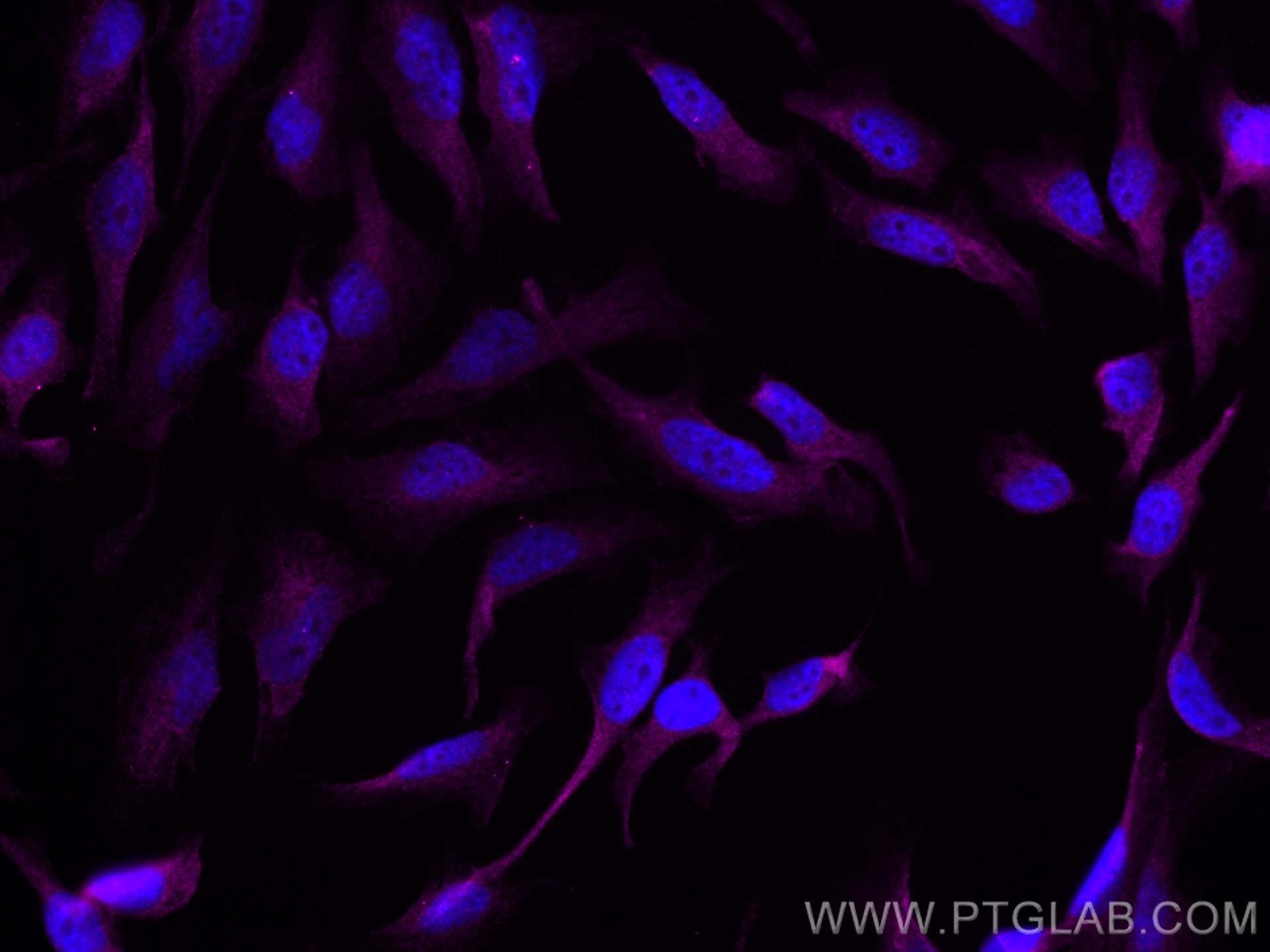 IF Staining of HeLa using CL647-60267