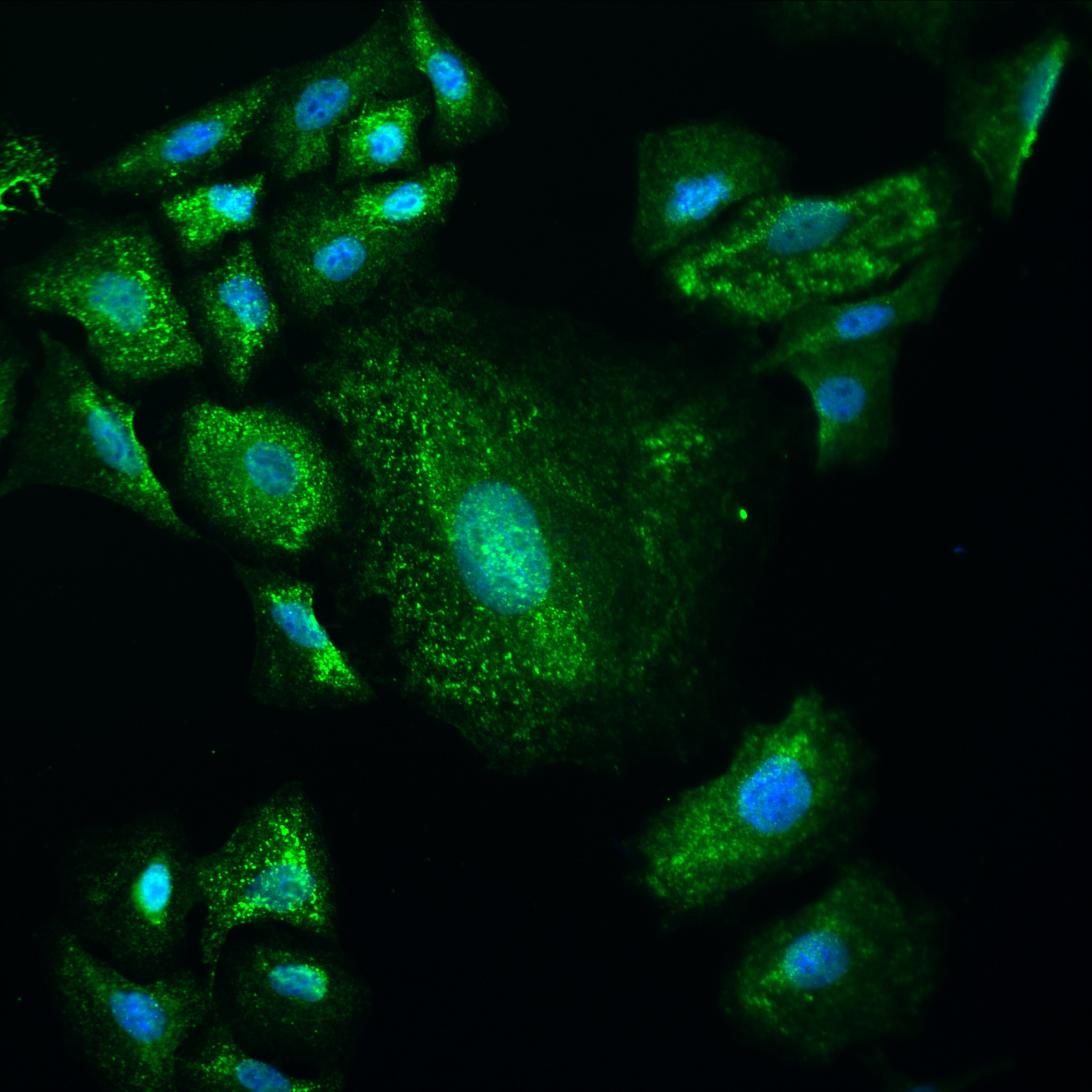 Immunofluorescence (IF) / fluorescent staining of A549 cells using BAZ2A Recombinant antibody (82910-2-RR)