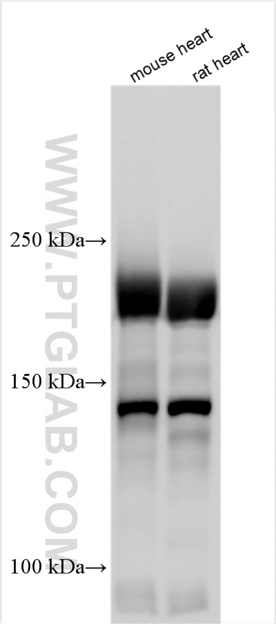 Western Blot (WB) analysis of various lysates using BAZ2B Polyclonal antibody (33437-1-AP)