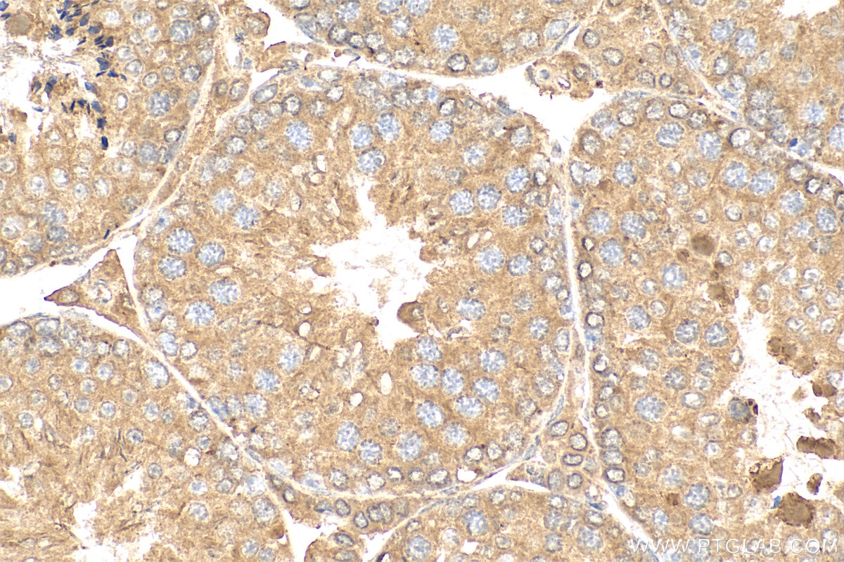Immunohistochemistry (IHC) staining of mouse testis tissue using BBOF1 Polyclonal antibody (24337-1-AP)