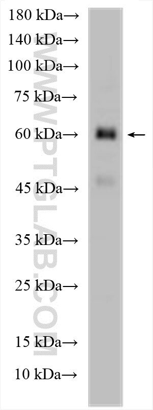 Western Blot (WB) analysis of TT cells using BBOF1 Polyclonal antibody (24337-1-AP)