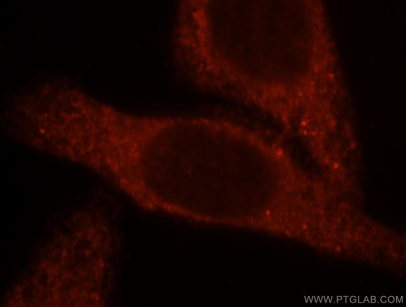 Immunofluorescence (IF) / fluorescent staining of HepG2 cells using BBOX1 Polyclonal antibody (16099-1-AP)