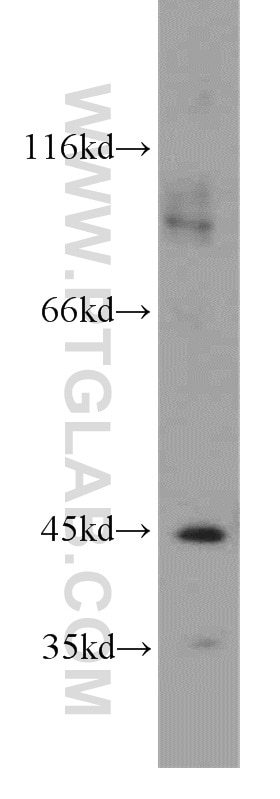 Western Blot (WB) analysis of human brain tissue using BBOX1 Polyclonal antibody (16099-1-AP)