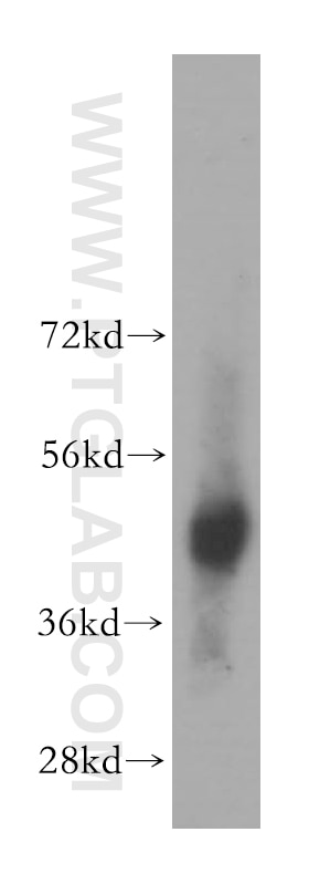 Western Blot (WB) analysis of human brain tissue using BBOX1 Polyclonal antibody (16099-1-AP)