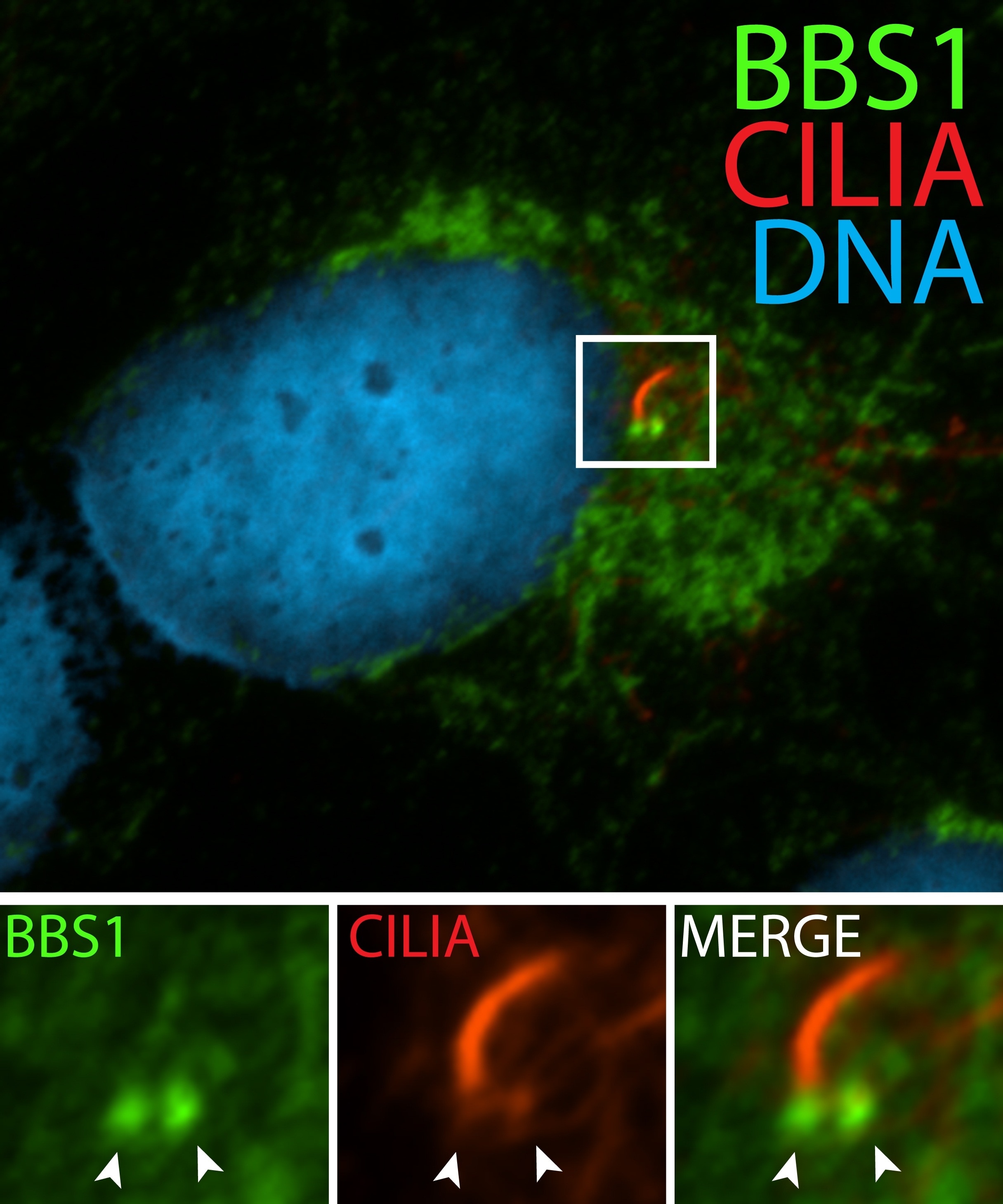 Immunofluorescence (IF) / fluorescent staining of hTERT-RPE1 cells using BBS1 Polyclonal antibody (21118-1-AP)