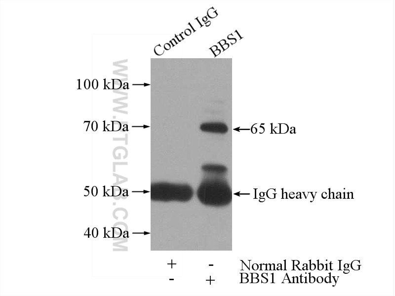 Immunoprecipitation (IP) experiment of mouse brain tissue using BBS1 Polyclonal antibody (21118-1-AP)