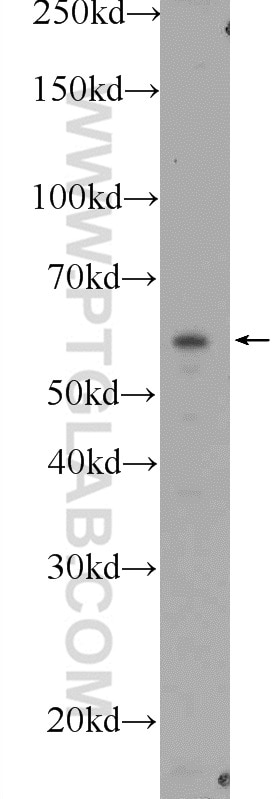 Western Blot (WB) analysis of mouse kidney tissue using BBS1 Polyclonal antibody (21118-1-AP)
