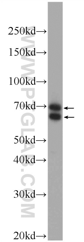 Western Blot (WB) analysis of mouse brain tissue using BBS1 Polyclonal antibody (21118-1-AP)