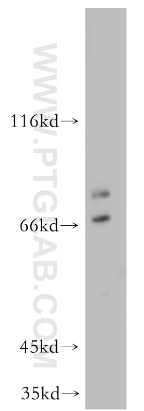 Western Blot (WB) analysis of mouse heart tissue using BBS1 Polyclonal antibody (21118-1-AP)