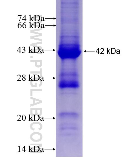 BBS1 fusion protein Ag15557 SDS-PAGE