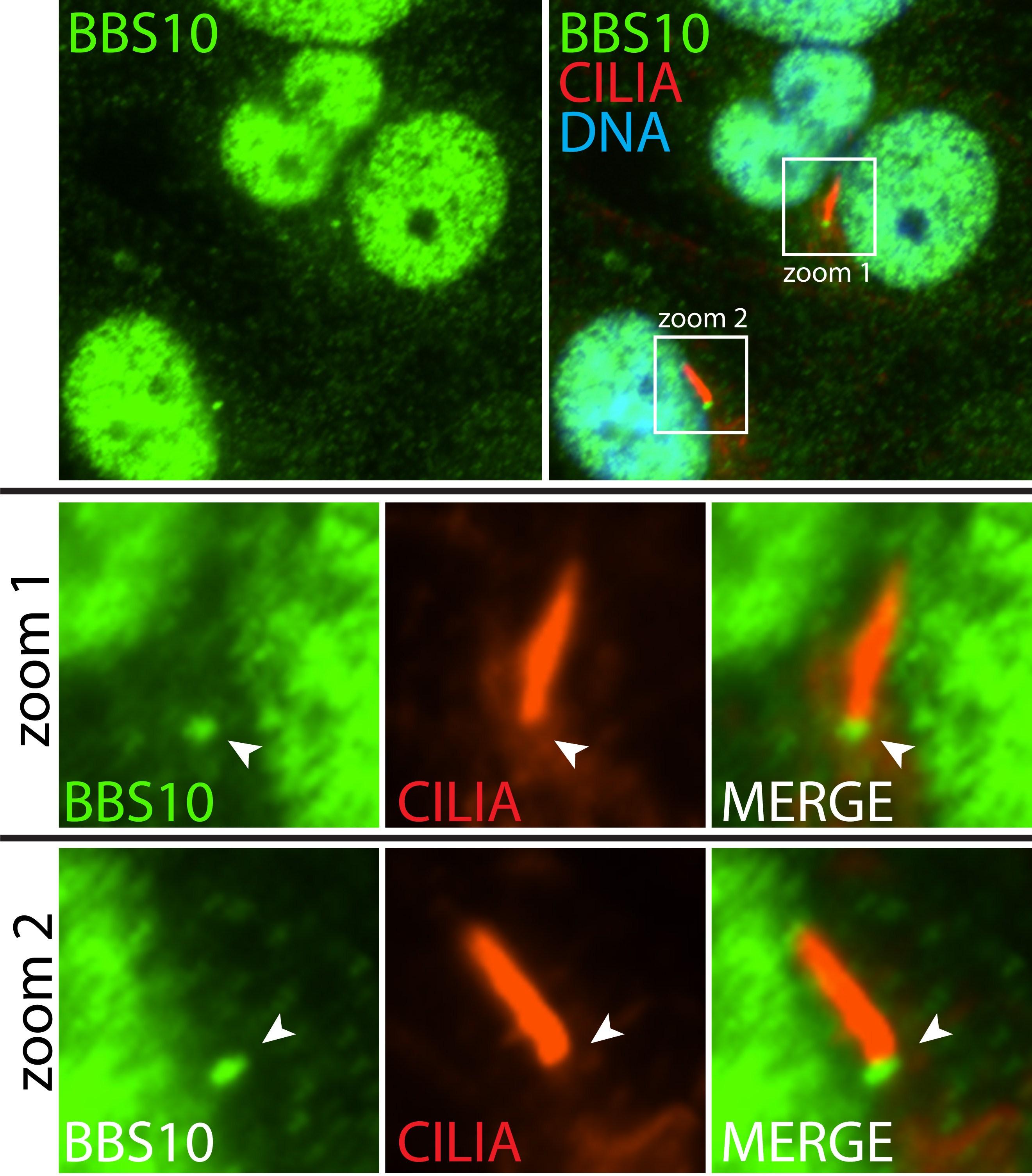 Immunofluorescence (IF) / fluorescent staining of hTERT-RPE1 cells using BBS10 Polyclonal antibody (12421-2-AP)